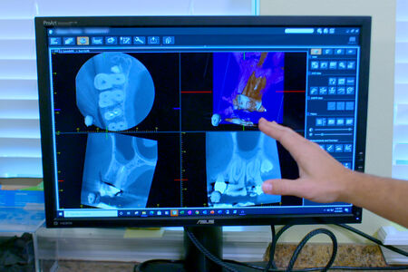CBCT images