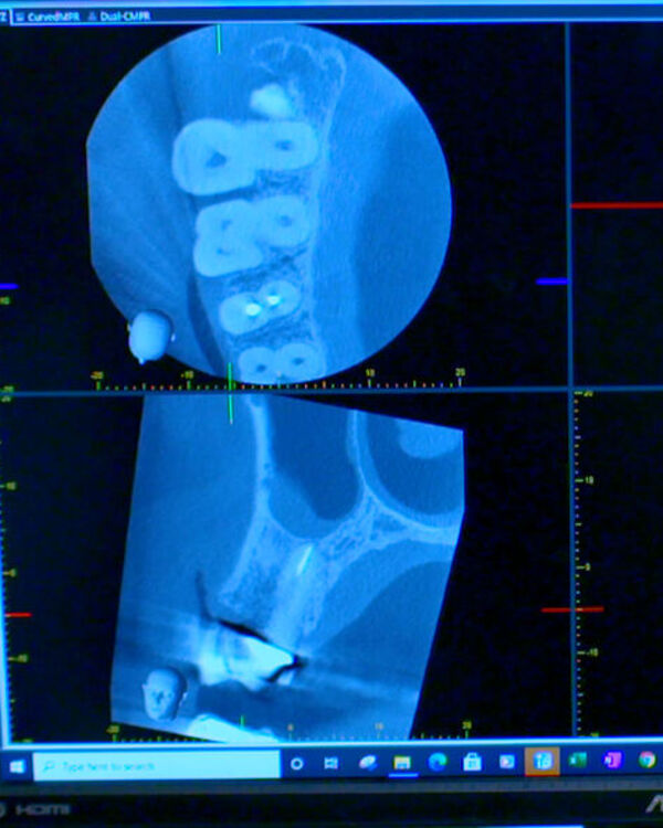 CBCT images