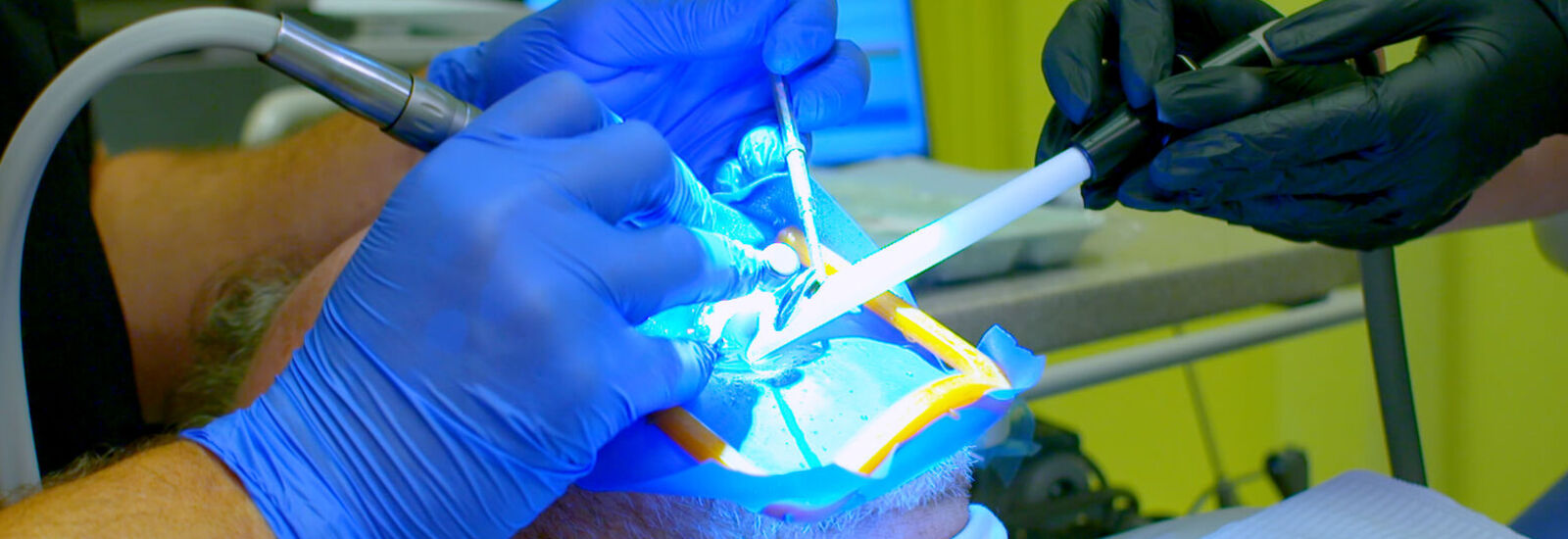 Close up of dental procedure